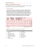 Preview for 64 page of Physio Control LIFEPAK 15 Operating Instructions Manual