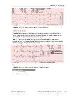 Preview for 65 page of Physio Control LIFEPAK 15 Operating Instructions Manual