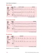 Preview for 166 page of Physio Control LIFEPAK 15 Operating Instructions Manual