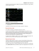 Preview for 177 page of Physio Control LIFEPAK 15 Operating Instructions Manual