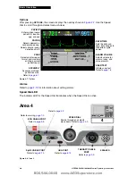 Preview for 31 page of Physio Control LIFEPAK 20 Manual