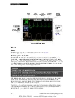 Preview for 35 page of Physio Control LIFEPAK 20 Manual