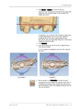 Предварительный просмотр 77 страницы Planmeca Chairside PlanCAD Easy User Manual