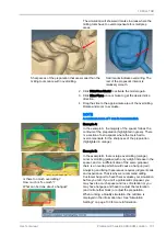 Предварительный просмотр 107 страницы Planmeca Chairside PlanCAD Easy User Manual
