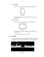 Preview for 32 page of Planmeca Proline XC Pan Calibration Manual