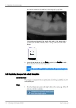 Preview for 16 page of Planmeca ProSensor HD User Manual