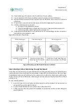 Предварительный просмотр 37 страницы PMD RespiraSense RS Device Instructions For Use Manual