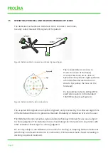 Предварительный просмотр 6 страницы Prolira DeltaScan Instructions For Use Manual