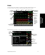 Preview for 13 page of Protocol Propaq 242 Directions For Use Manual