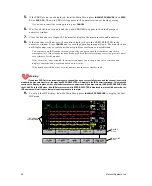 Preview for 34 page of Protocol Propaq 242 Directions For Use Manual