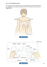 Preview for 23 page of QT Medical QT ECG Recorder User Manual