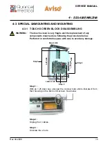 Preview for 13 page of Quantel Medical Aviso Service Manual