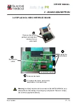 Предварительный просмотр 13 страницы Quantel Medical Axis II PR Service Manual