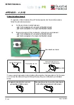 Предварительный просмотр 32 страницы Quantel Medical Axis II PR Service Manual