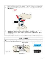 Preview for 7 page of Repatha Pushtronex Instructions For Use Manual