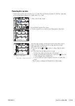 Preview for 63 page of ResMed Elisee 350 Clinical Manual