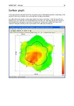 Preview for 34 page of RINNTECH ARBOTOM User Manual