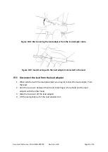 Предварительный просмотр 29 страницы SALUDA MEDICAL Evoke 12C Surgical Manual