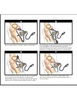 Предварительный просмотр 7 страницы SAM MEDICAL IO Stabilizer Instructions For Use Manual