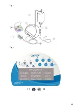 Preview for 62 page of Satelec ACteon i-Surge+ User Manual