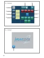 Preview for 246 page of Satelec Implant Center 2 User Manual