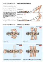 Preview for 9 page of Saviour Medical SAVIOUR stretchers TACTICAL Manual And Technical Specifications