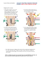 Предварительный просмотр 15 страницы Saviour Medical TECHNICAL STRETCHER Information