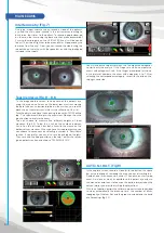 Preview for 14 page of SBM IDRA User Manual