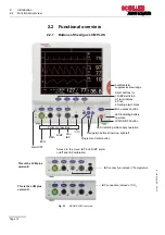 Preview for 14 page of Schiller ARGUS LCM Operating Instruction