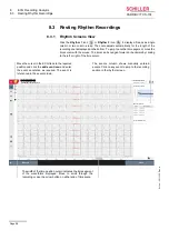 Предварительный просмотр 96 страницы Schiller CARDIOVIT CS-104 User Manual