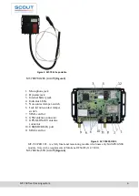 Предварительный просмотр 6 страницы Scout MT-700 ENT Operation Manual