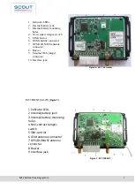 Предварительный просмотр 7 страницы Scout MT-700 ENT Operation Manual