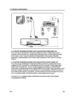 Предварительный просмотр 11 страницы Sencor SDV 7201H User Manual