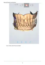 Preview for 75 page of Shining3D Aoralscan 2 User Manual