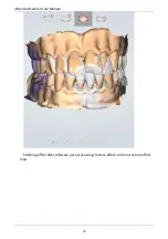 Preview for 76 page of Shining3D Aoralscan 2 User Manual