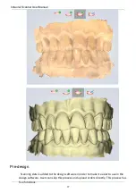 Preview for 77 page of Shining3D Aoralscan 2 User Manual