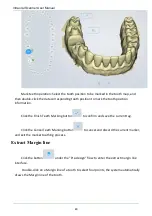 Preview for 80 page of Shining3D Aoralscan 2 User Manual