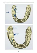 Preview for 83 page of Shining3D Aoralscan 2 User Manual