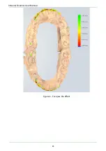 Preview for 85 page of Shining3D Aoralscan 2 User Manual