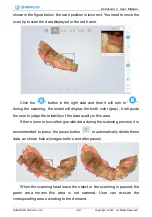 Preview for 43 page of SHNING 3D Aoralscan 2 User Manual