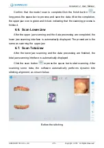 Preview for 44 page of SHNING 3D Aoralscan 2 User Manual