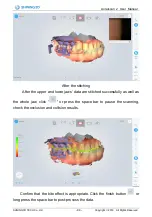 Preview for 45 page of SHNING 3D Aoralscan 2 User Manual