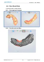 Preview for 46 page of SHNING 3D Aoralscan 2 User Manual