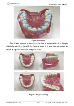 Preview for 69 page of SHNING 3D Aoralscan 2 User Manual