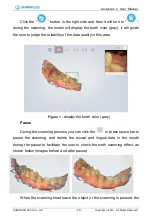 Preview for 71 page of SHNING 3D Aoralscan 2 User Manual