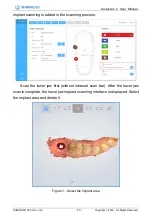 Preview for 75 page of SHNING 3D Aoralscan 2 User Manual