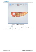 Preview for 76 page of SHNING 3D Aoralscan 2 User Manual