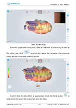 Preview for 80 page of SHNING 3D Aoralscan 2 User Manual