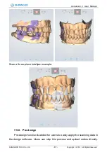 Preview for 82 page of SHNING 3D Aoralscan 2 User Manual