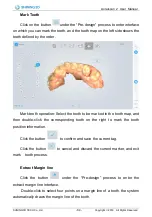 Preview for 85 page of SHNING 3D Aoralscan 2 User Manual